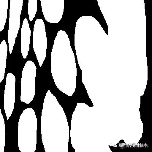Tensorflow入门教程（十三）——医学图像分割案例_tensorflow_04